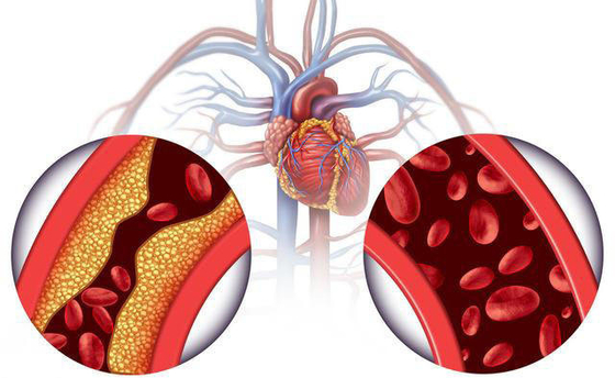 ツルの茶ツルの茶エキスのdihydromyricetinの粉98%からのOEMの商標のdihydromyricetin